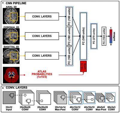 Transductive Transfer Learning for Domain Adaptation in Brain Magnetic Resonance Image Segmentation